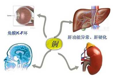 人体黄瓜视频下载APP数据能够准检测出但身体中微量元素铜超标会引起疾病发生 人体黄瓜视频下载APP数据能够准检测出但身体中微量元素铜超标会引起疾病发生